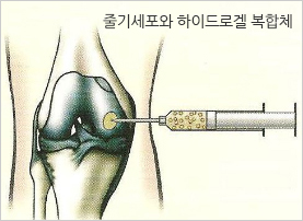 줄기세포1