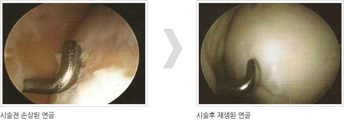 줄기세포