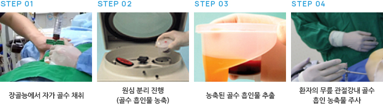 줄기세포